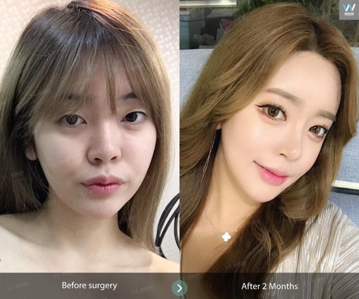 ศัลยกรรมโครงหน้า