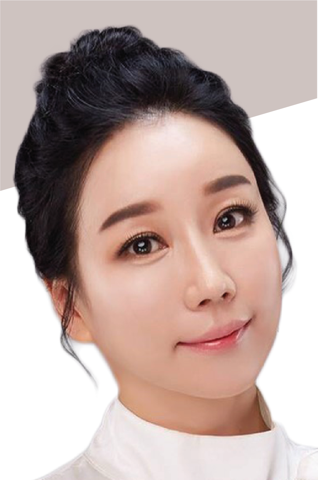 รักษาแผลเป็น