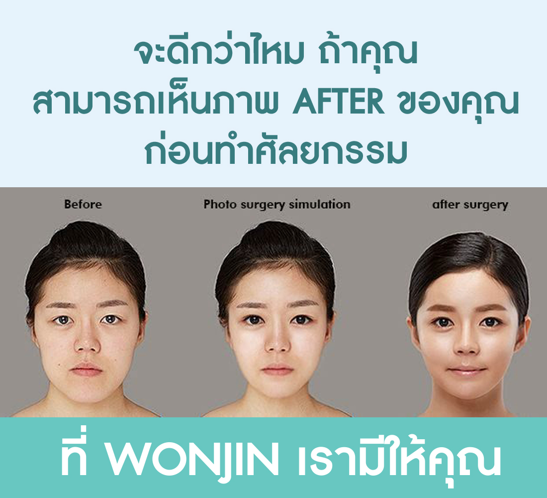 ร้อยไหมที่ไหนดี