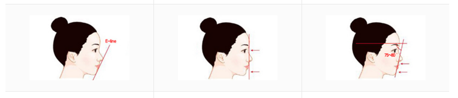 ศัลยกรรมหน้า