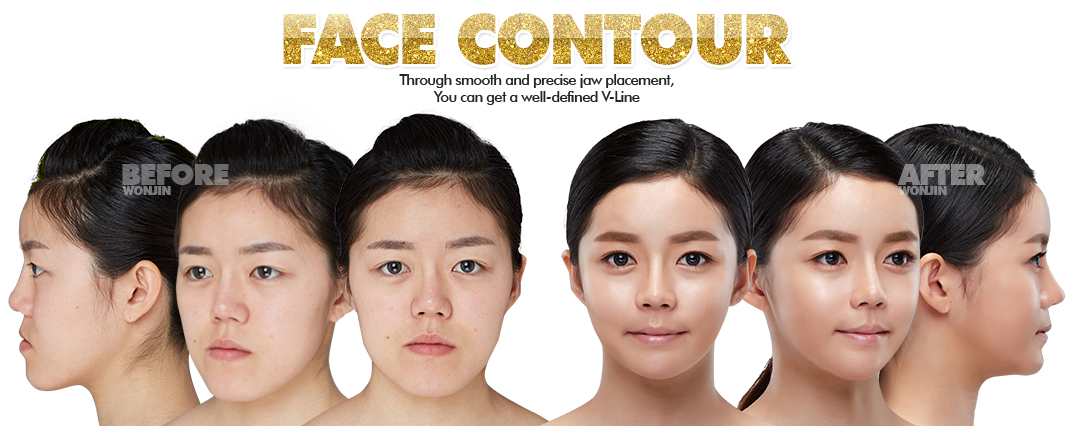 ศัลยกรรมหน้า