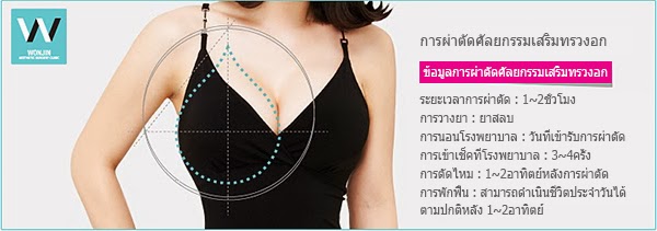 เสริมหน้าอกวอนจิน