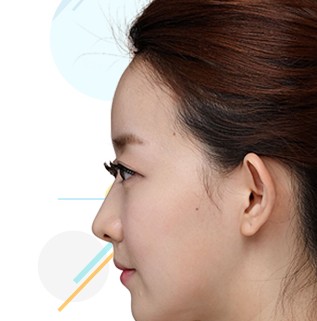 เสริมดั้ง