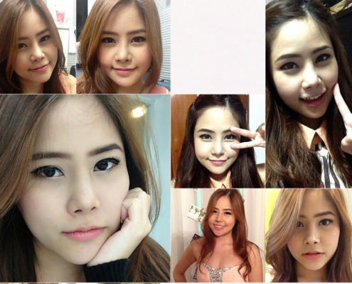 รีวิว ศัลยกรรมหน้าที่เกาหลี