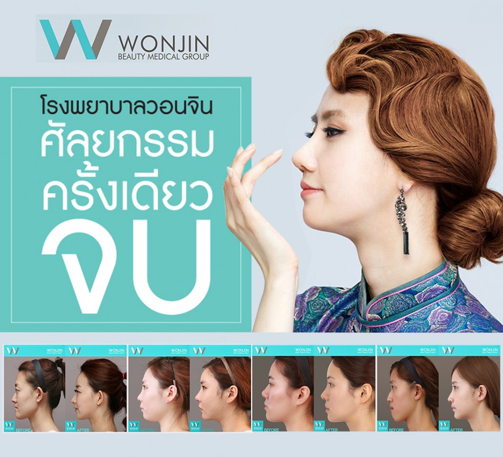 ตัดปีกจมูก