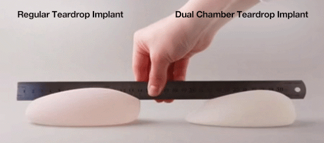 เสริมหน้าอก ทำนม