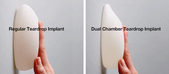 เสริมหน้าอก ทำนม