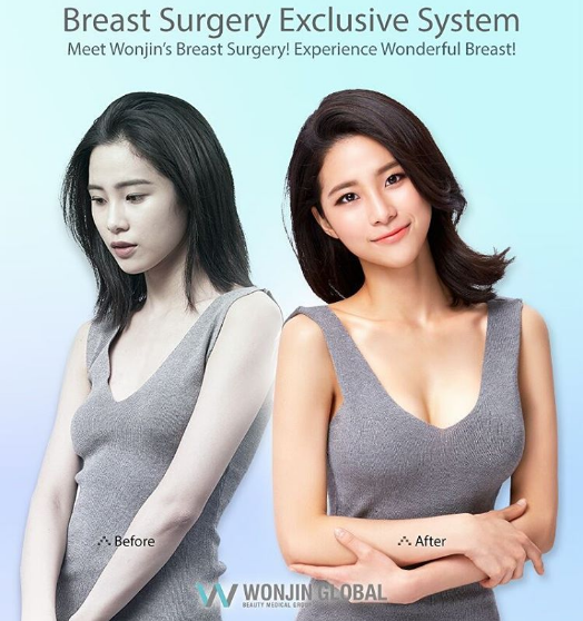 ศัลยกรรมหน้าอก