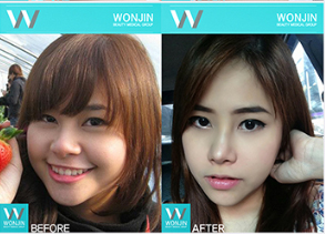 ศัลยกรรมหน้า