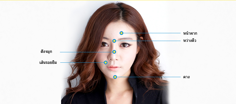 ฟิลเลอร์คาง