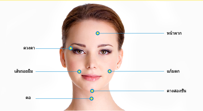 ร้อยไหม