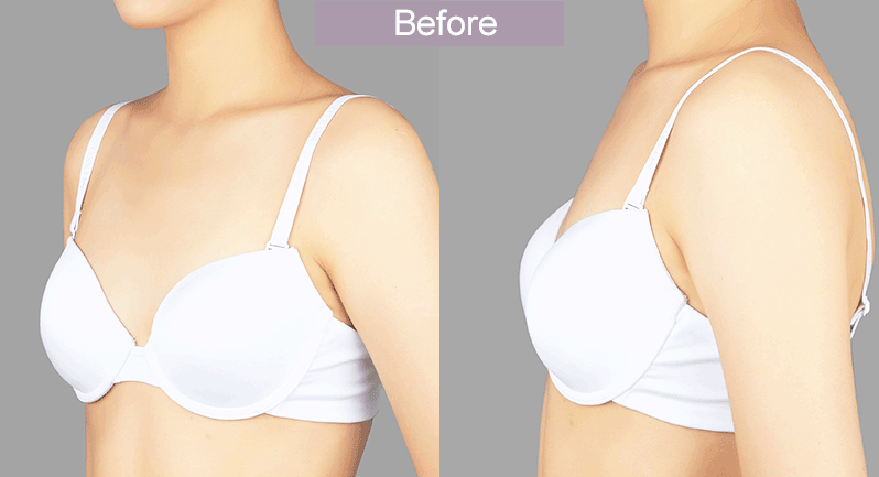 ทรงหยดน้ำ