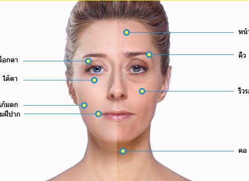 ยกกระชับหน้า