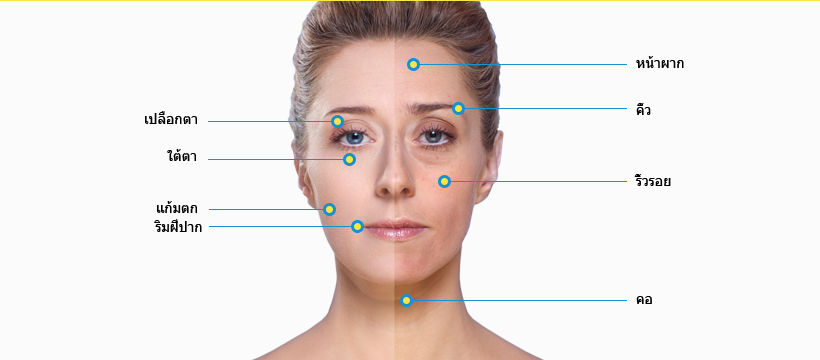 ยกกระชับหน้า