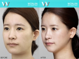 ปรับรูปหน้า