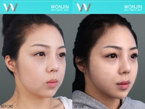 ปรับรูปหน้า