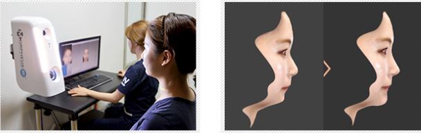 ทำจมูกที่วอนจิน