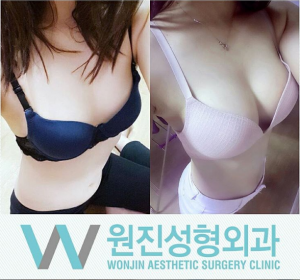 ศัลยกรรมหน้าอกของโรงพยาบาลวอนจิน