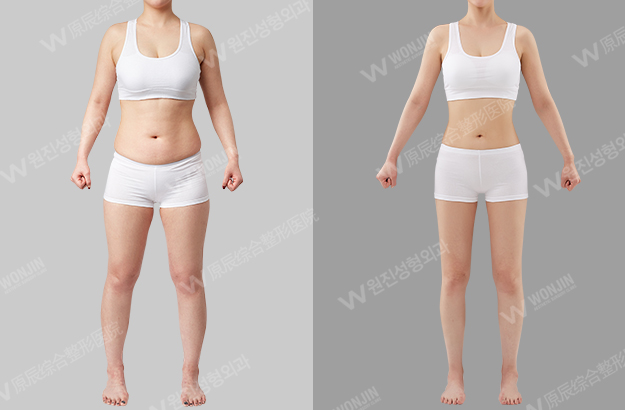 ทำขาเล็กเรียว