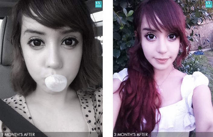 ศัลยกรรมเกาหลี