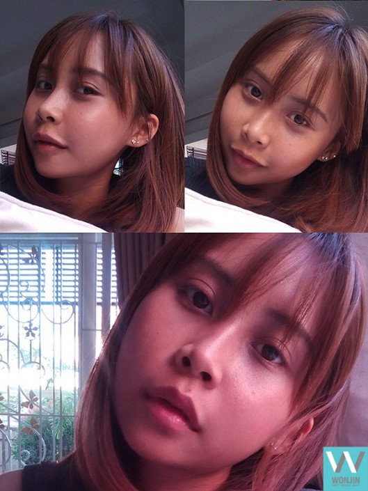 ศัลยกรรมขากรรไกร