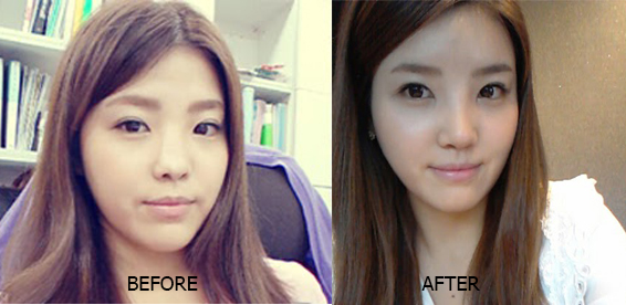 โรงพยาบาลวอนจิน