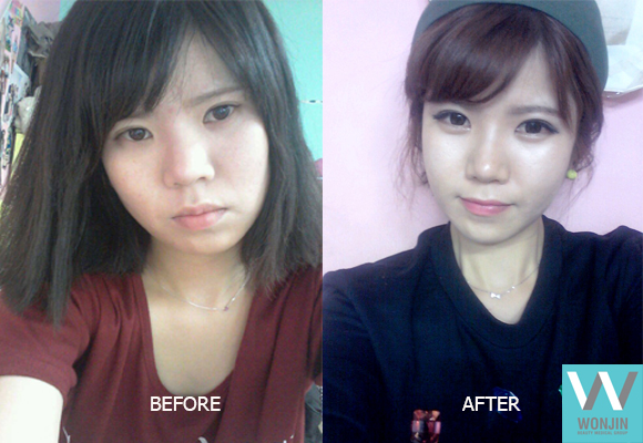 โรงพยาบาลศัลยกรรมวอนจิน