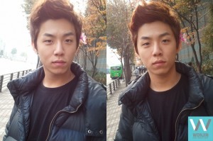 รีวิวศัลยกรรมวอนจิน