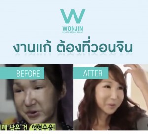 ศัลยกรรมเกาหลี