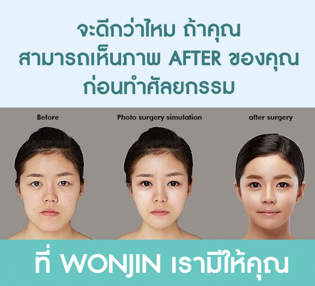 ศัลยกรรมเกาหลี