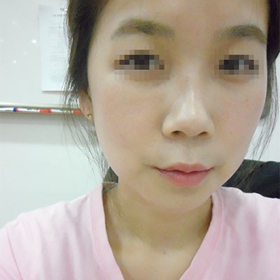 ศัลยกรรมเปลี่ยนอายุ