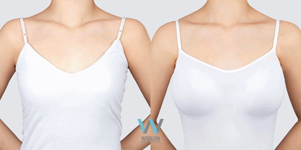 เสริมหน้าอก ทำนม