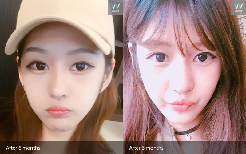 หลัง 6 เดือน