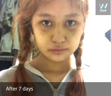 หลัง 7 วัน