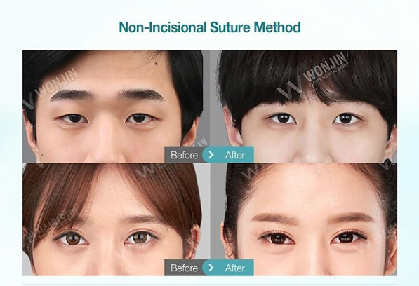 เปิดหัวตา