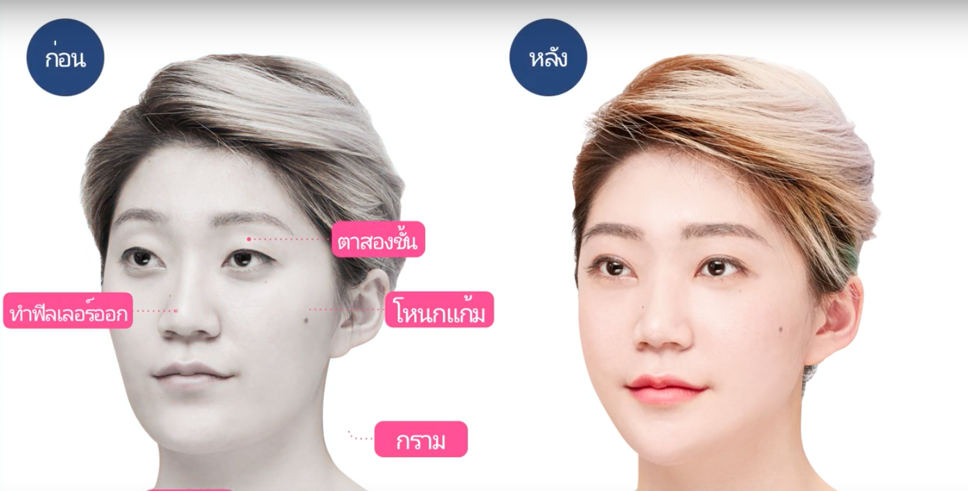 ศัลยกรรมตา