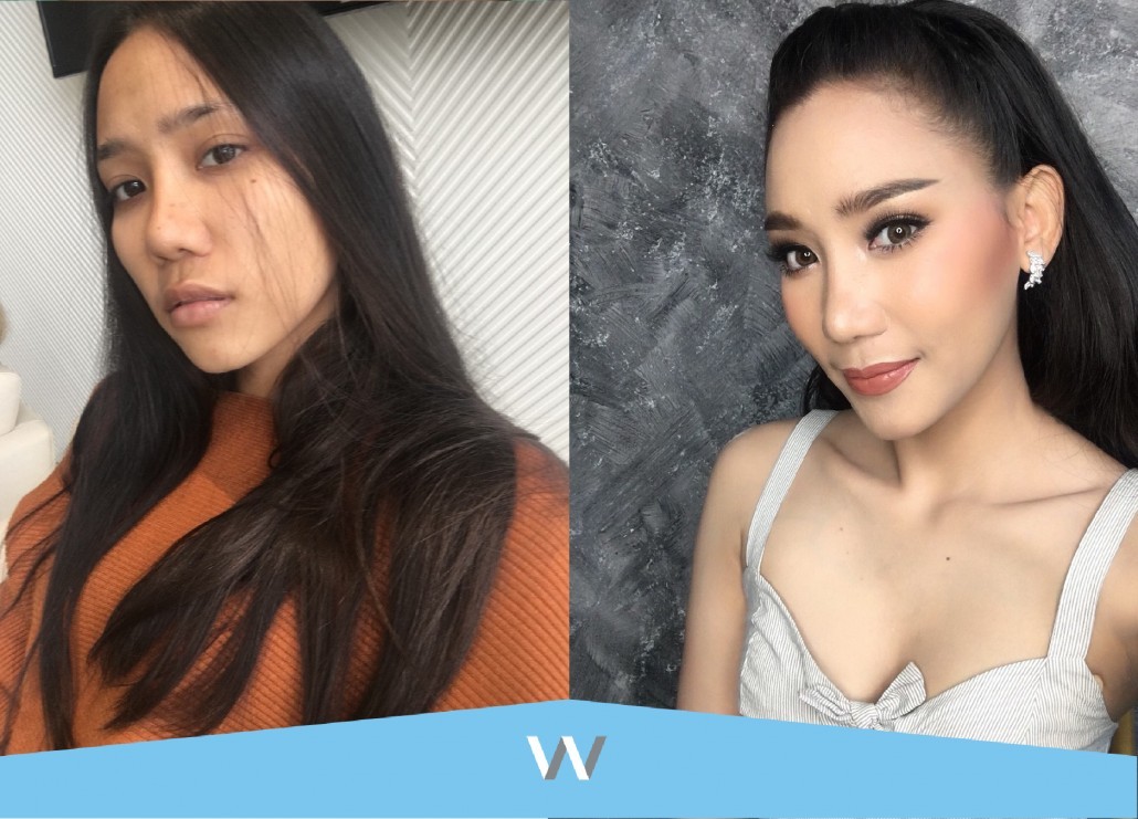 จมูกโด่ง