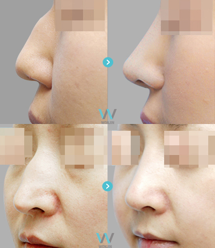 ภฬนฬม๖-4_06