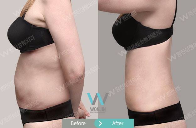 14639593_635799129931717_2070143876936246228_n