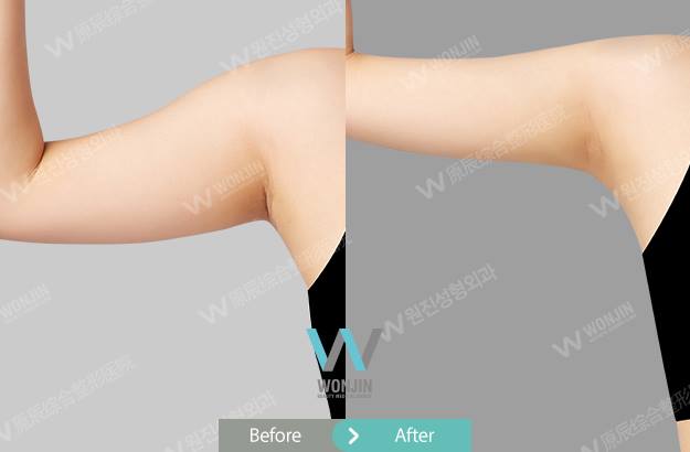 14657531_635799159931714_7016223518097070758_n