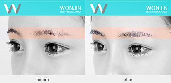 medinent_befor-and-after-01