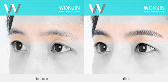 medinent_befor-and-after-04