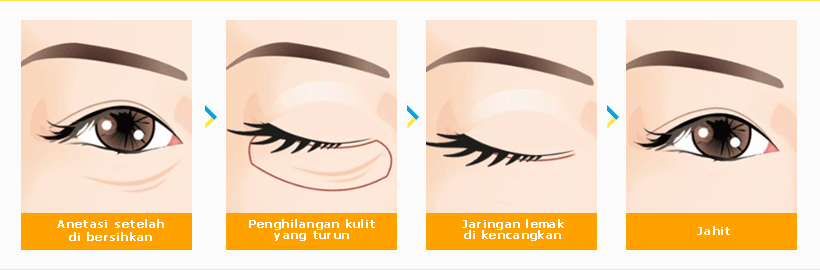 ตาสวยวอนจิน