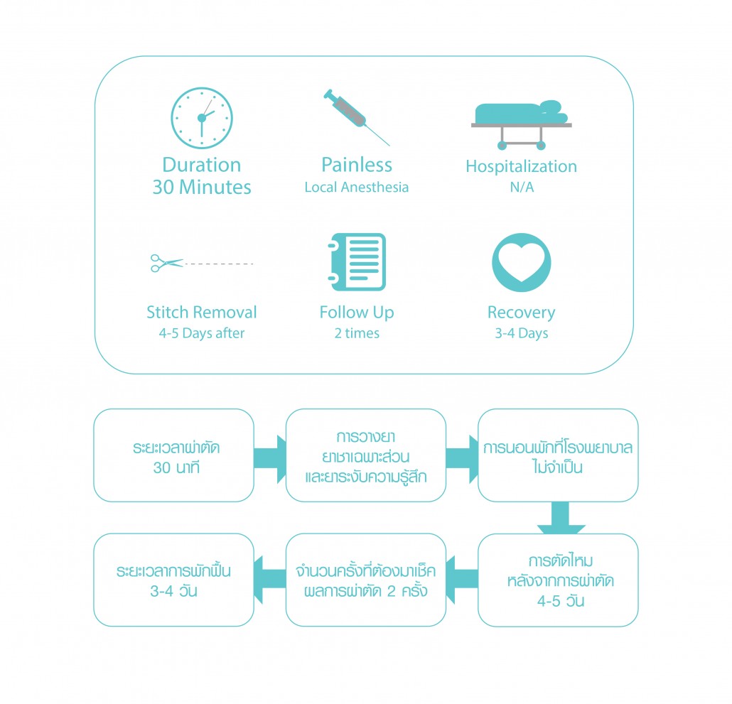ศัลยกรรมตา 3-01