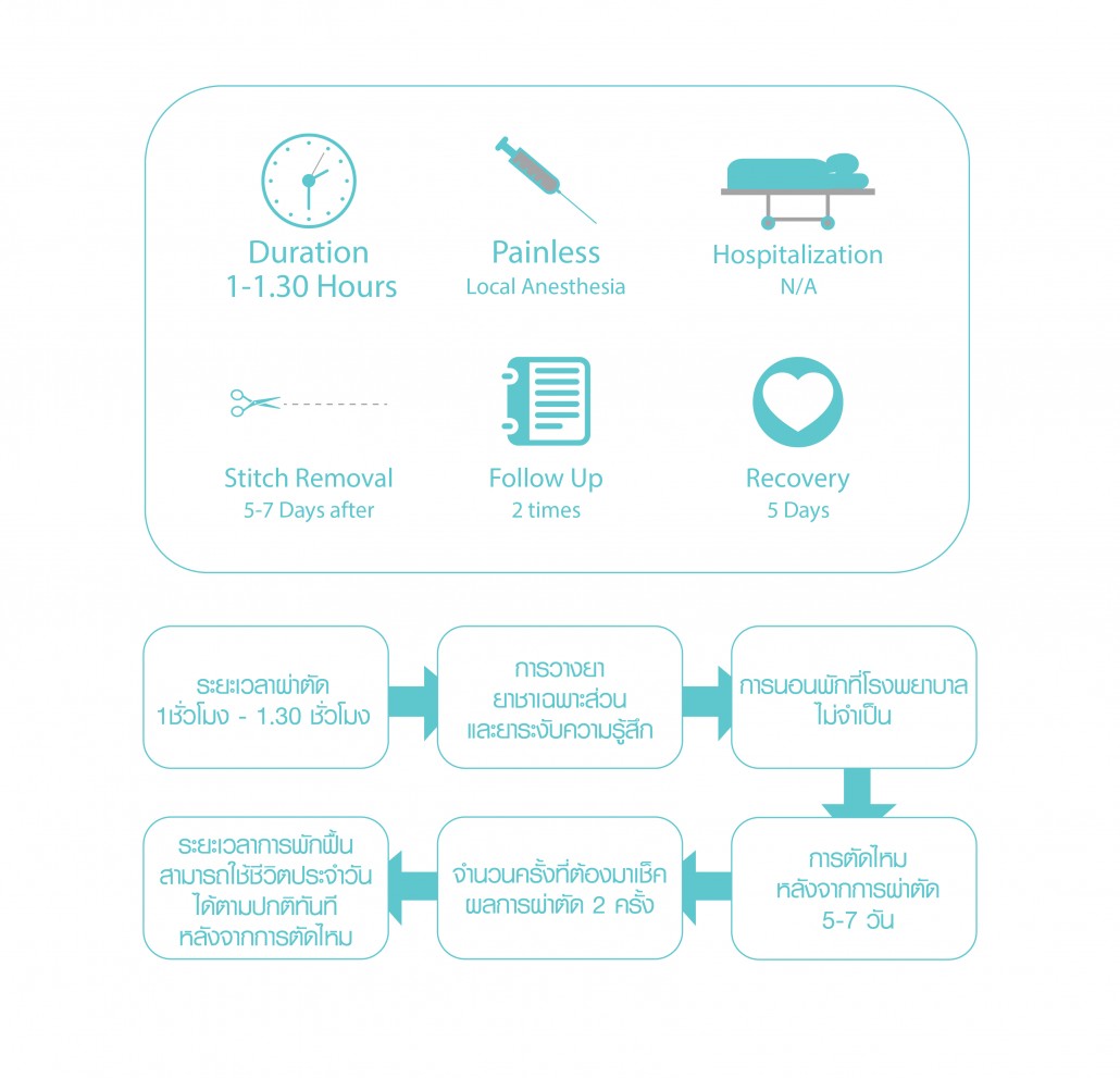 ศัลยกรรมตา 4-01