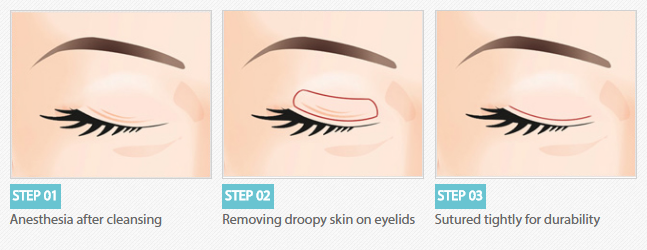 ตาสองชั้นวอนจิน