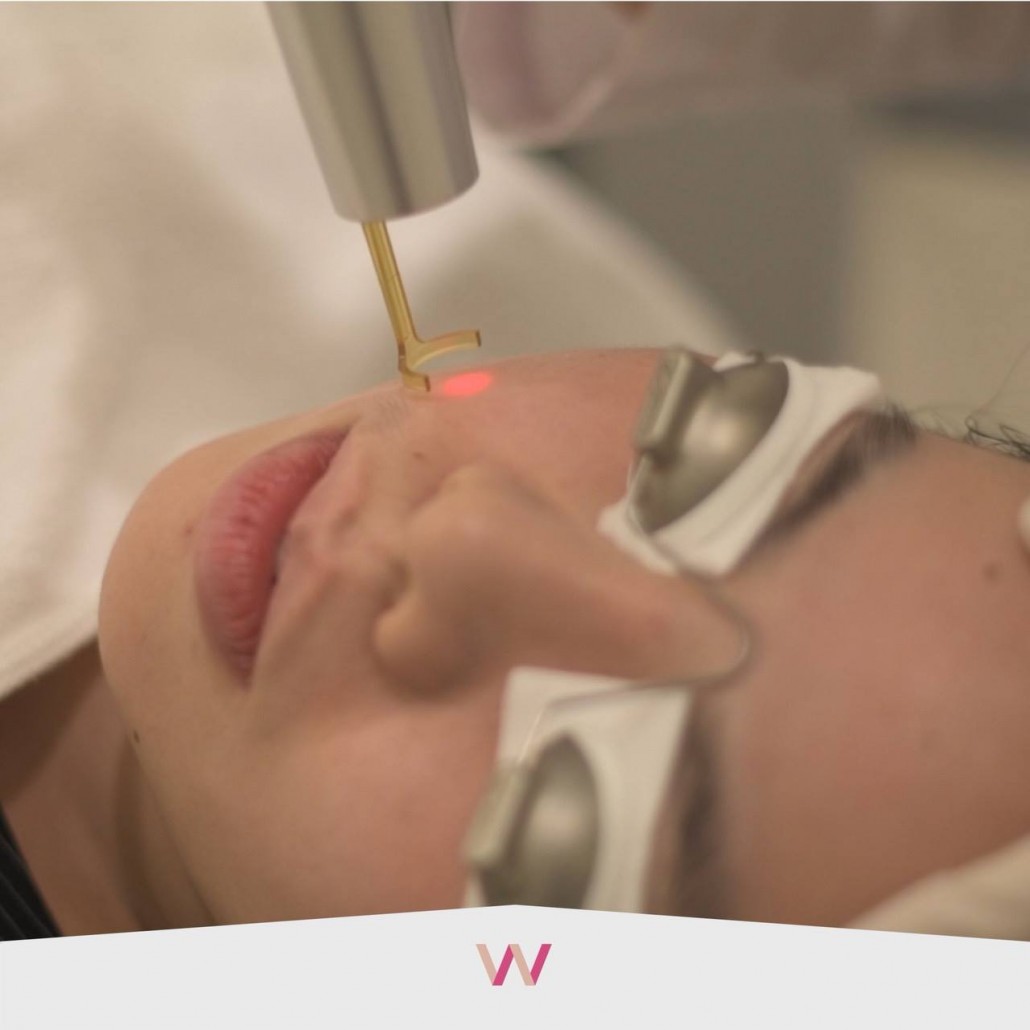 เลเซอร์รอยแผลเป็น