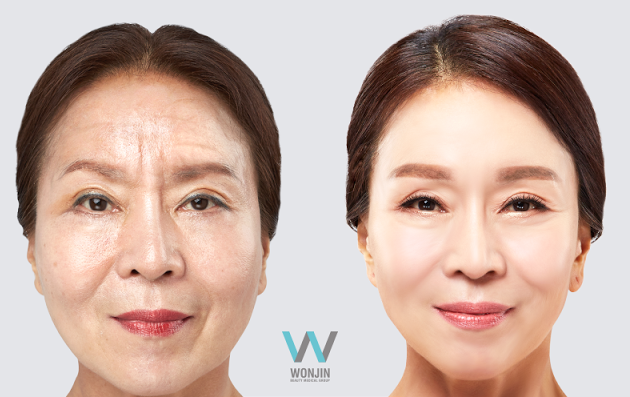 anti-aging-002