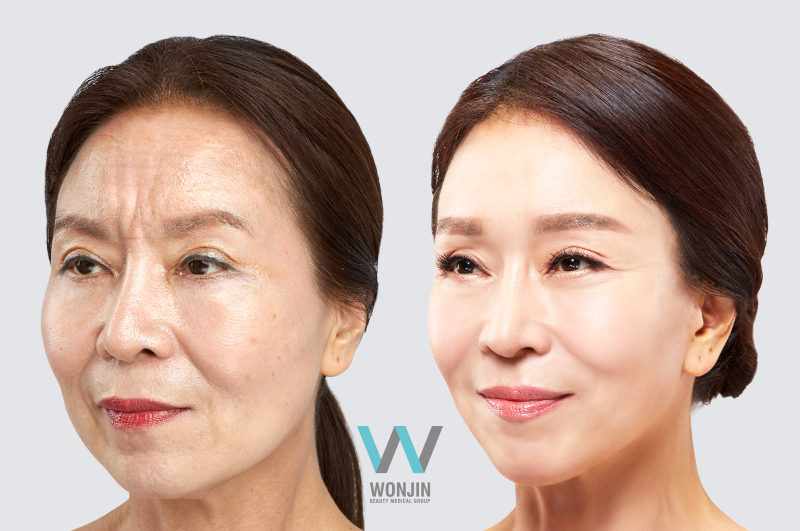 anti-aging-007