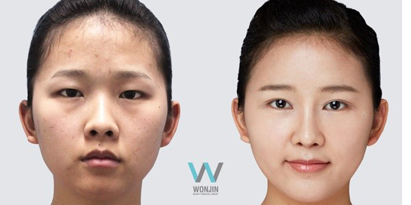 ทำตาสองชั้น